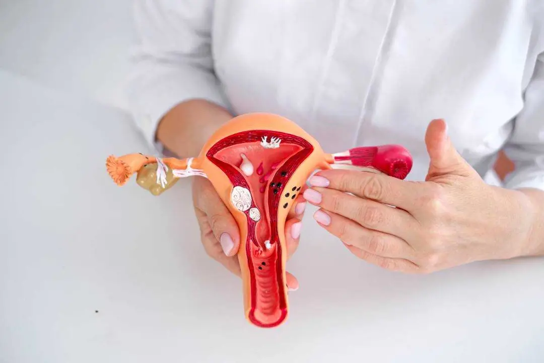 Como-se-diagnostica-la-endometriosis