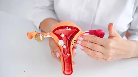 Como-se-diagnostica-la-endometriosis